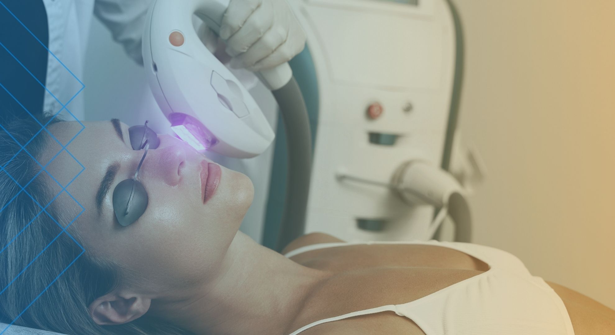 4 Skin Conditions That Can Be Reduced Or Removed By Laser IPL