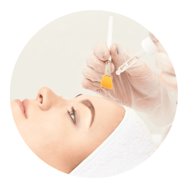 Chemical Peel at K2 Derm