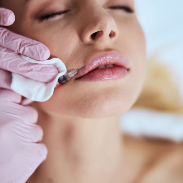 Fillers
If you’d like to achieve a more youthful appearance, dermal fillers may be an option. At K2 Dermatology Clinic, some of the most common areas of the body that we inject fillers are around the eyes, lips, and forehead, as well as in the neck and hands. This type of treatment fills wrinkles and smoothens complexion texture.