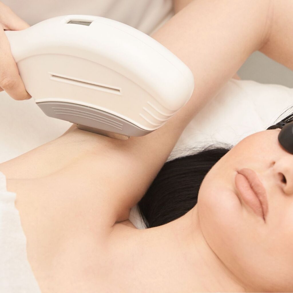 Preparing for Your IPL Session - armpit IPL