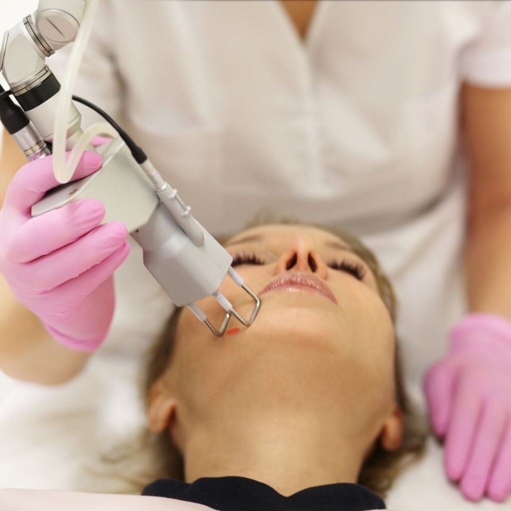 IPL vs. Laser Treatments