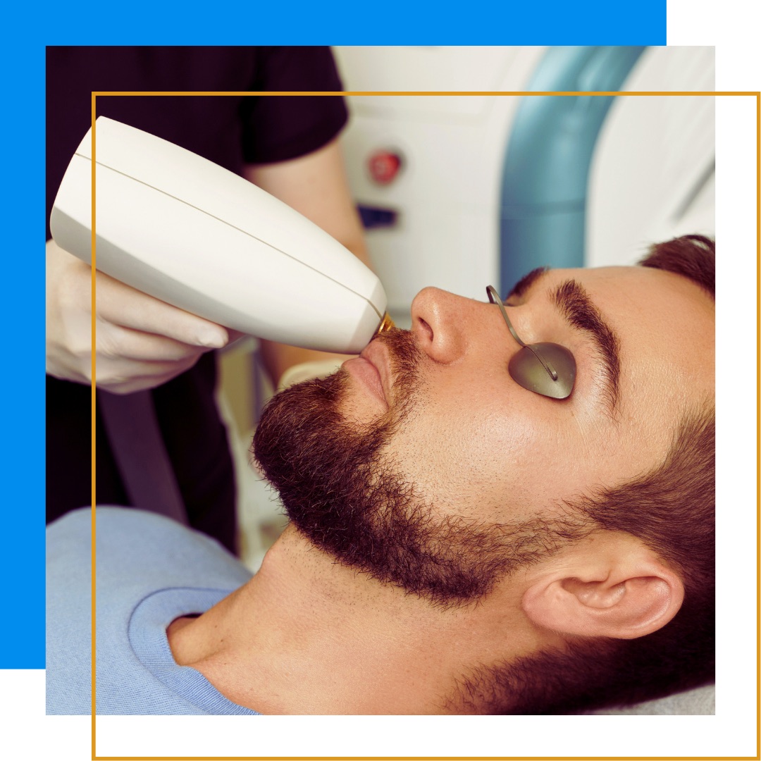 Bearded man getting IPL technology procedure on face