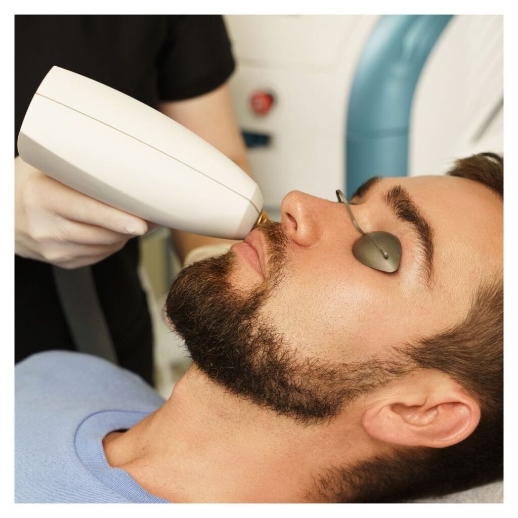 Choose IPL for Acne Scars - bearded man getting IPL treatment