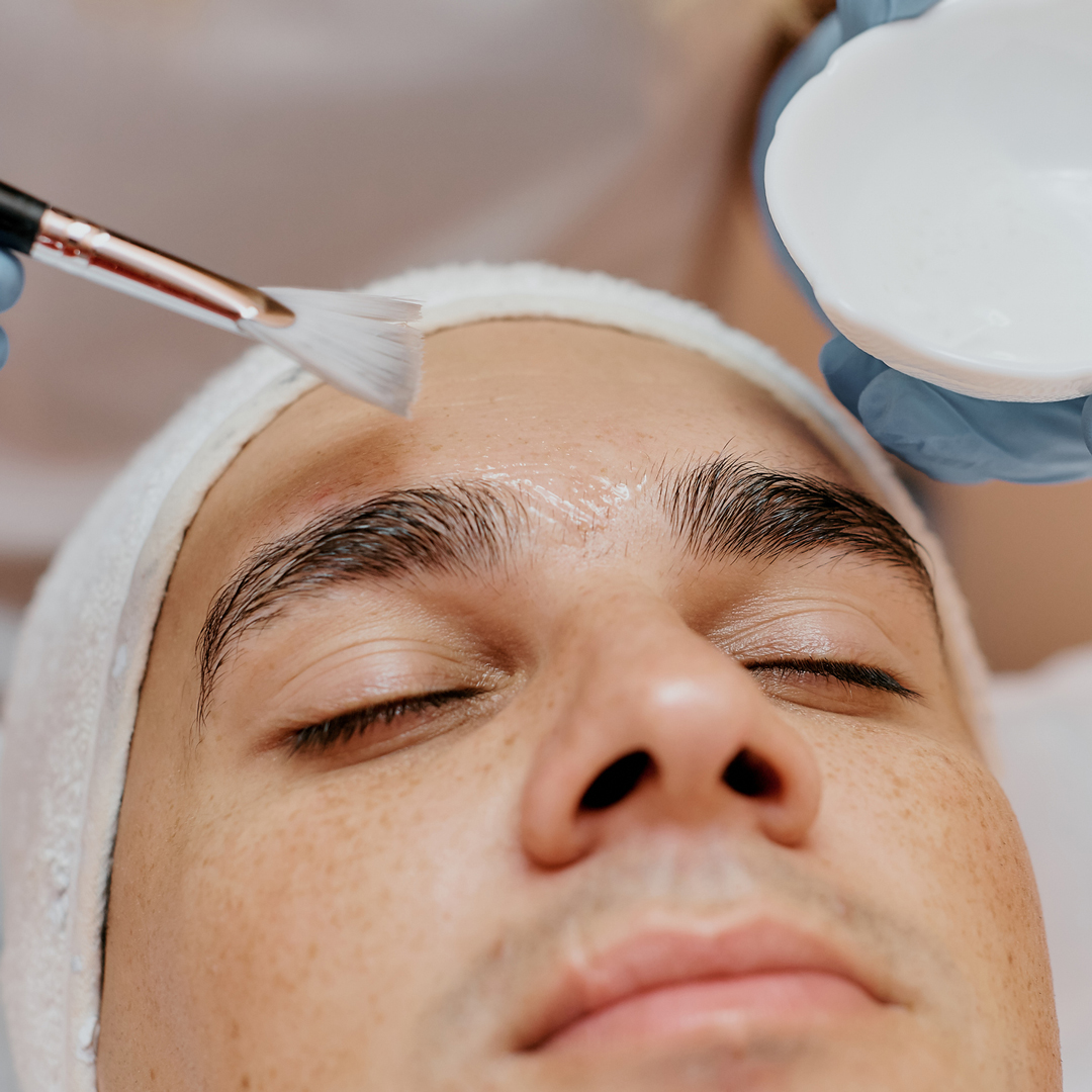 Man getting chemical peel for his face