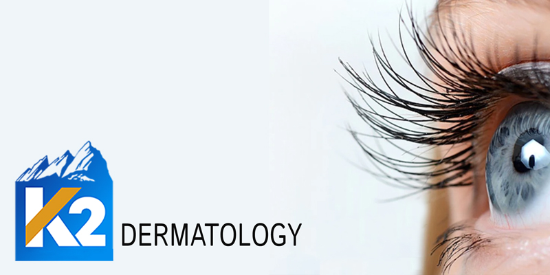 K2 Dermatology Latisse long lashes