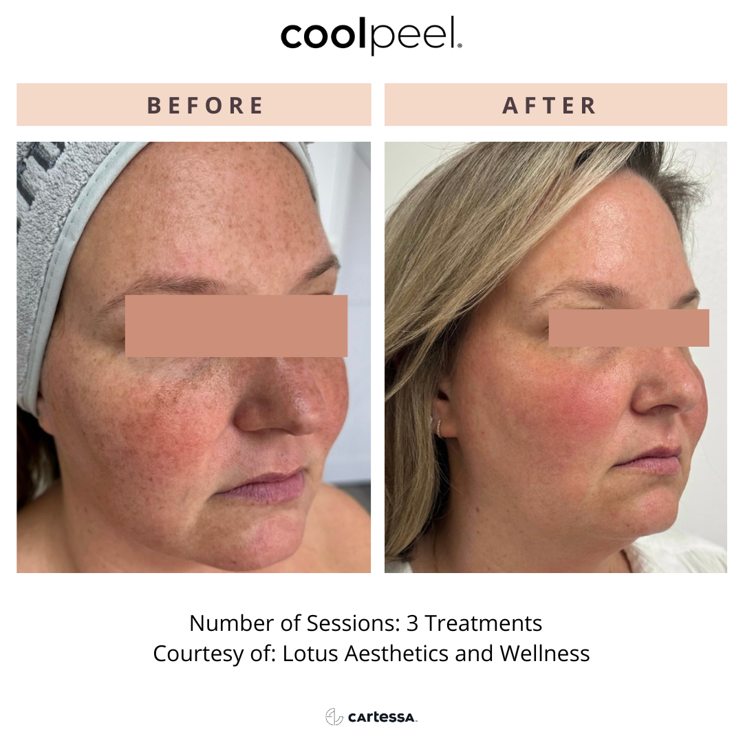 CPLotusAesFaceFemaleTemplate23168373415176