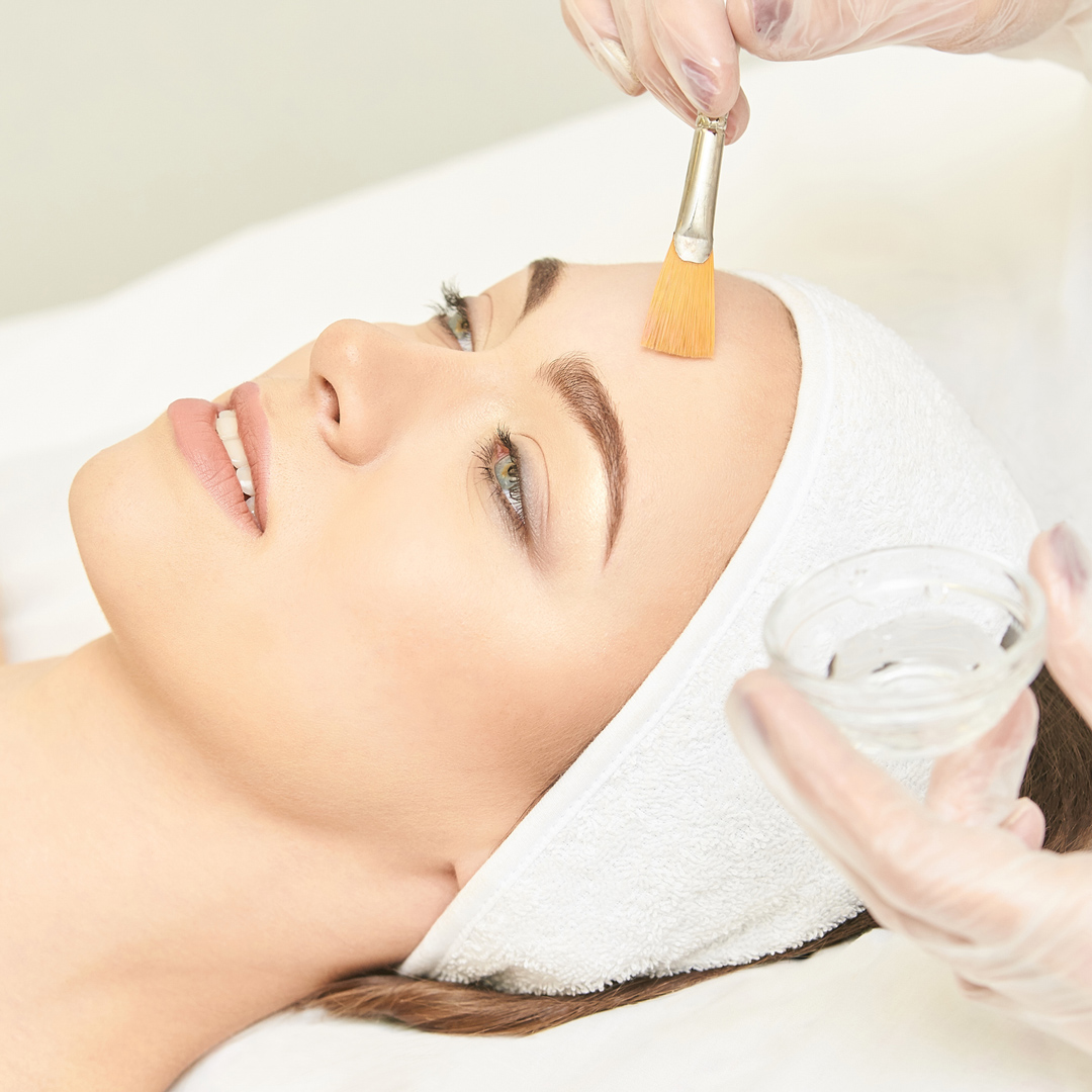 Chemical Peels showing women receiving treatment at K2 Derm
