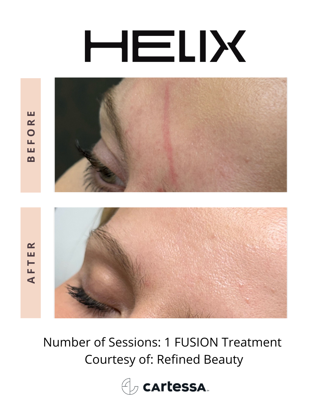 HELIXBA442177066395021