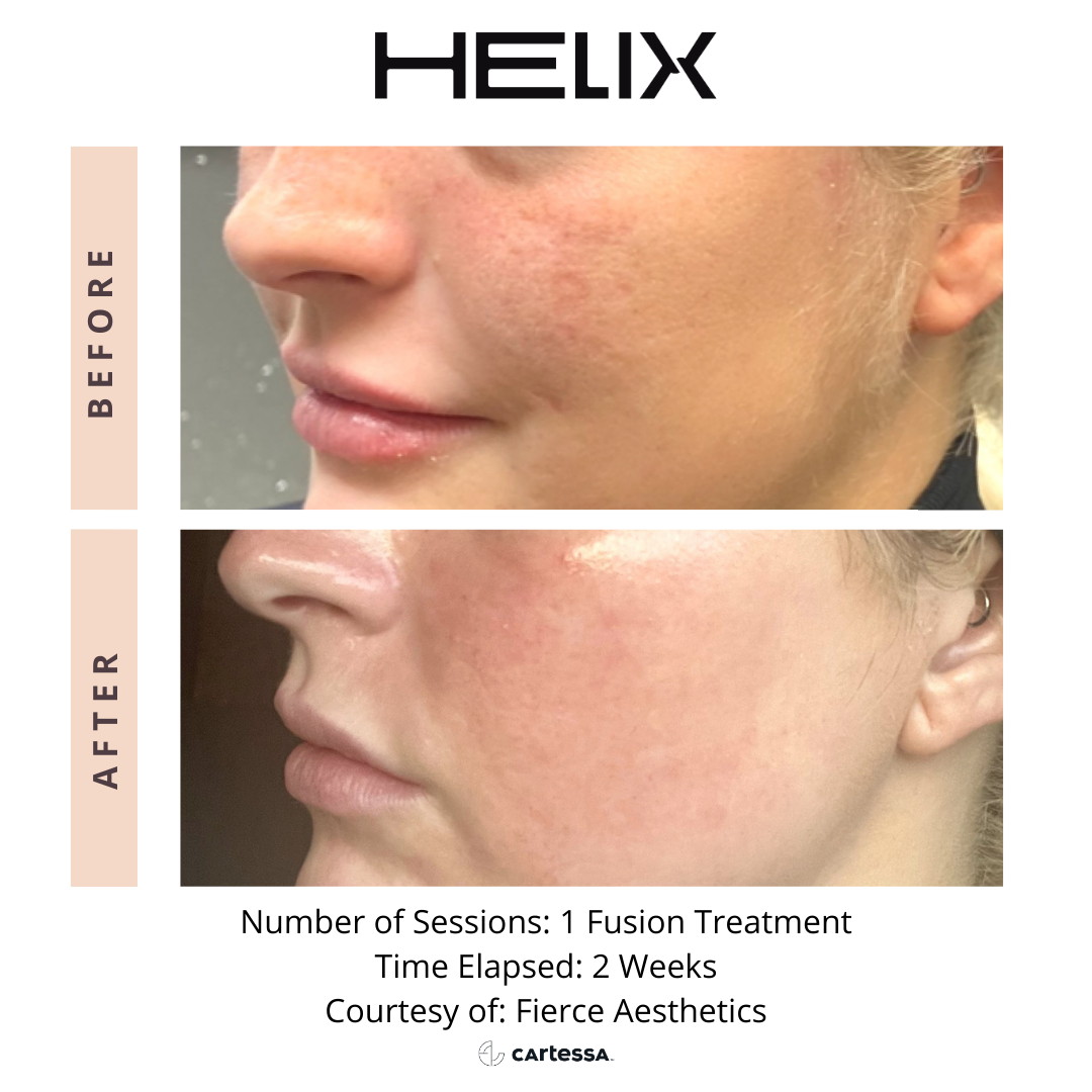 Helix10169522879754
