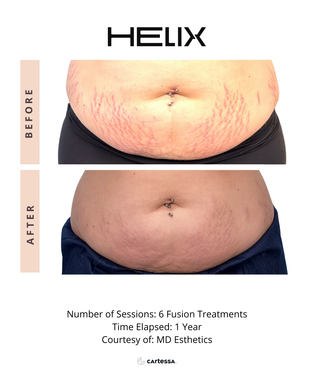 Helix10174015726983