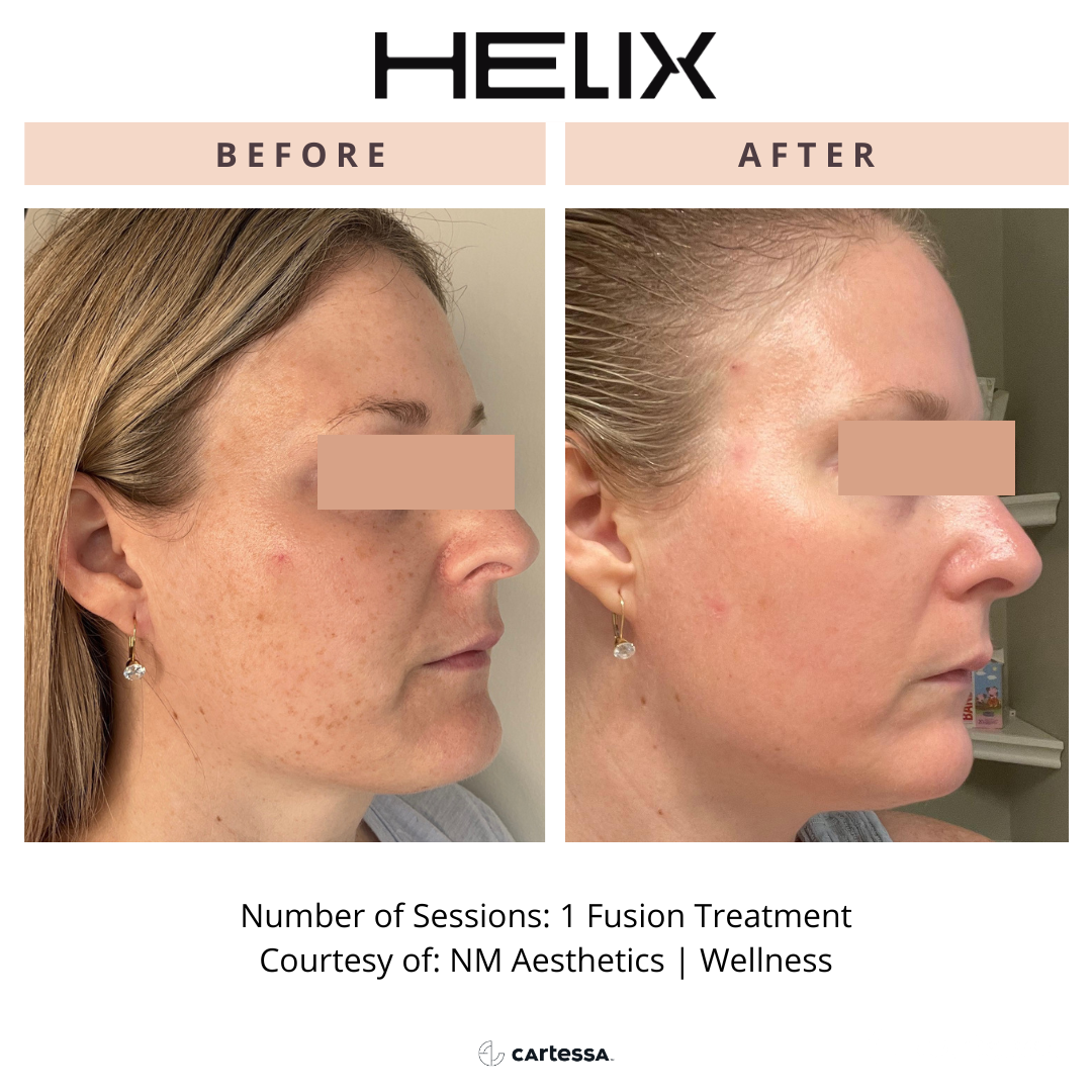 Helix7169340698271