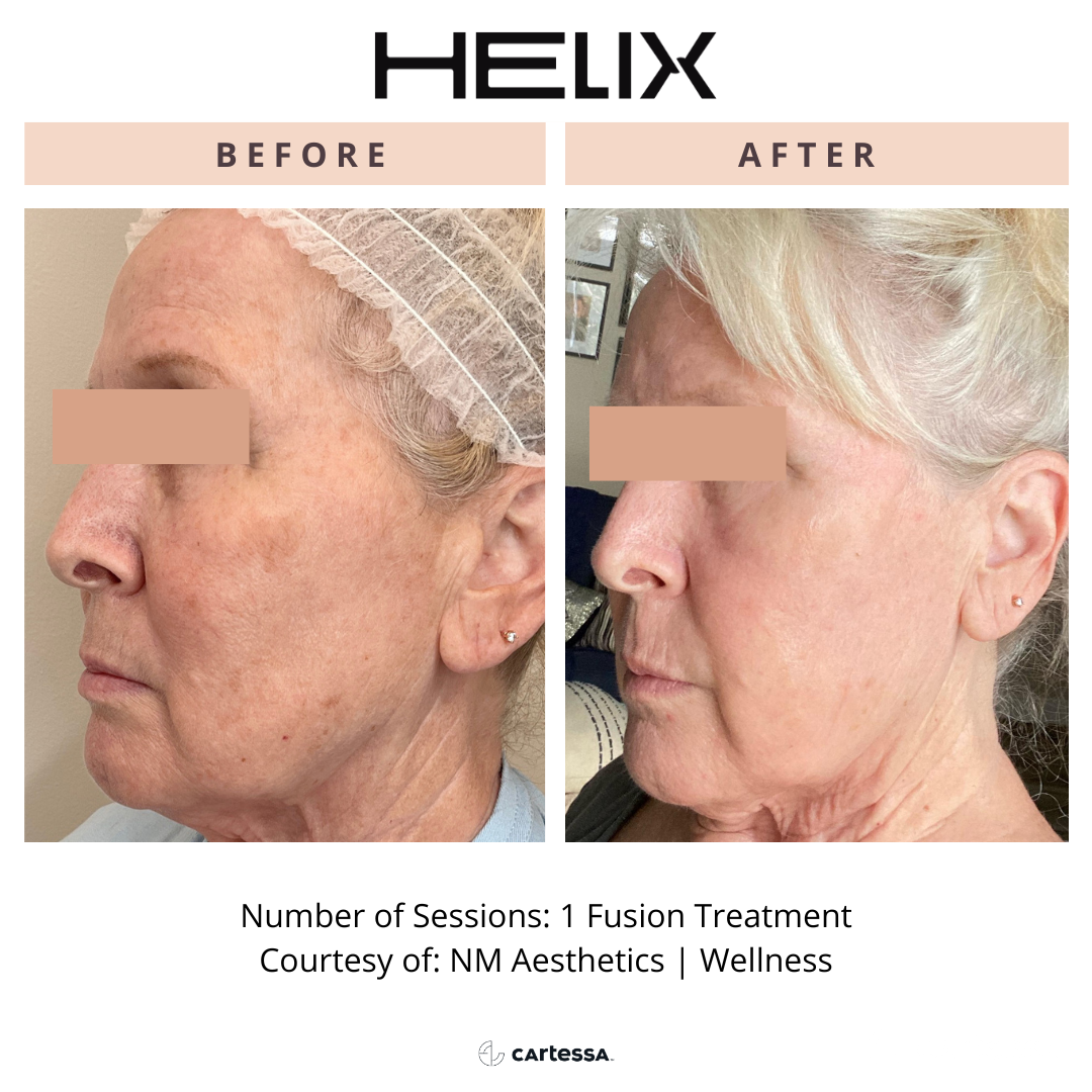 Helix8169340698082