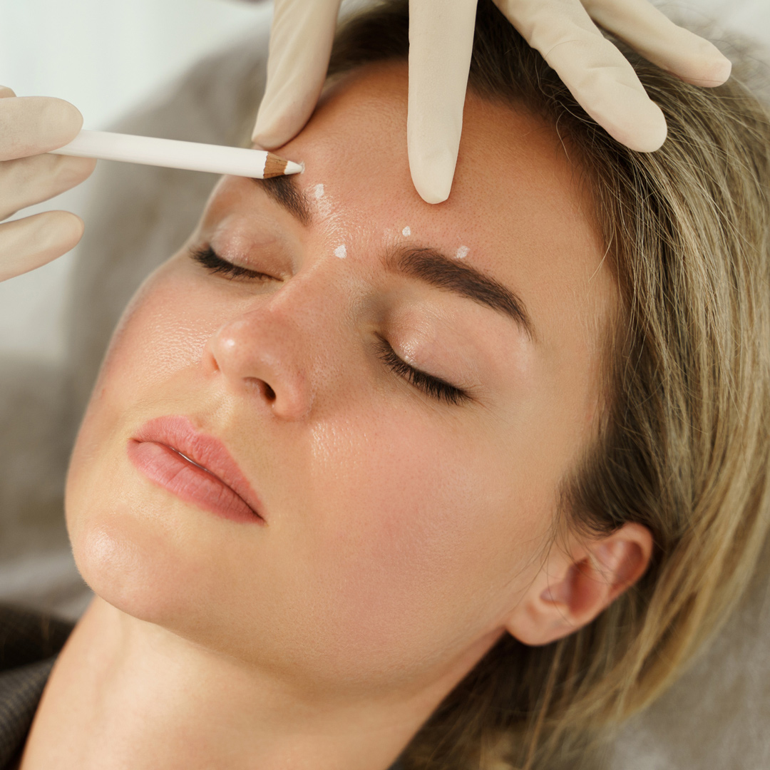 Marking woman's forehead for Botox injections