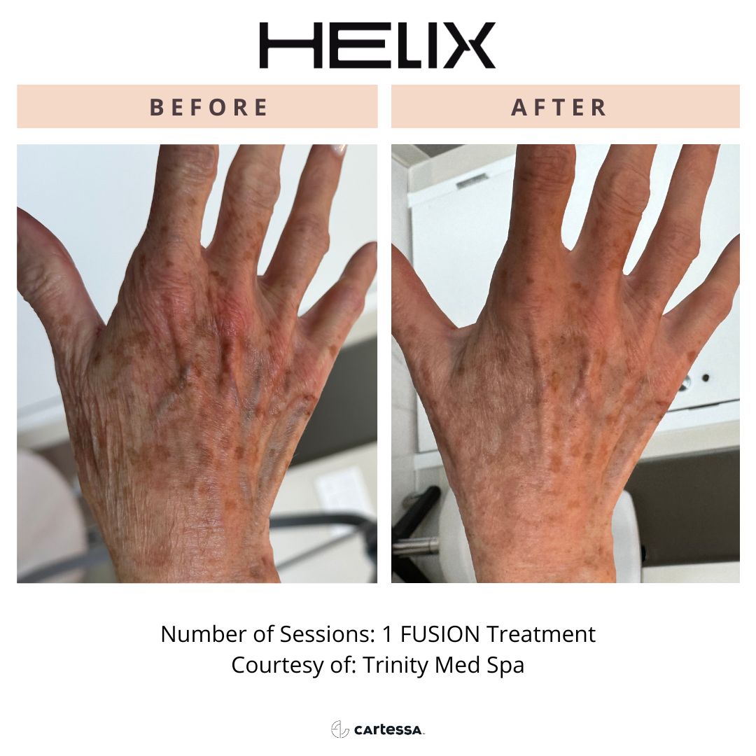 Trinity MedSpa Hands