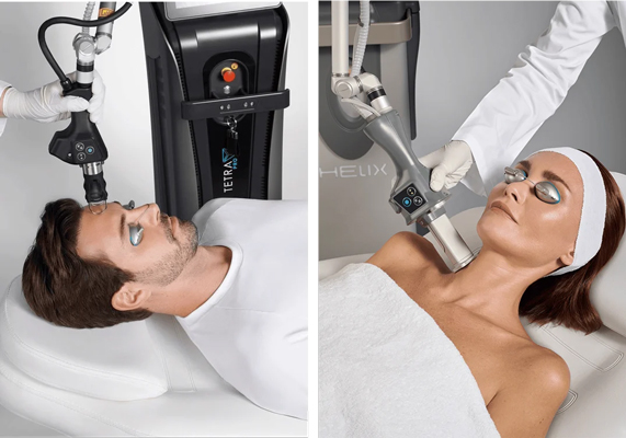 Picture of man and woman receiving HELIX skin resurfacing treatment
